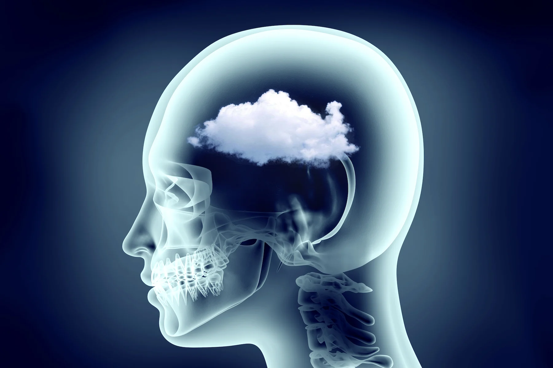 Brain Fog: 6 Potential Causes